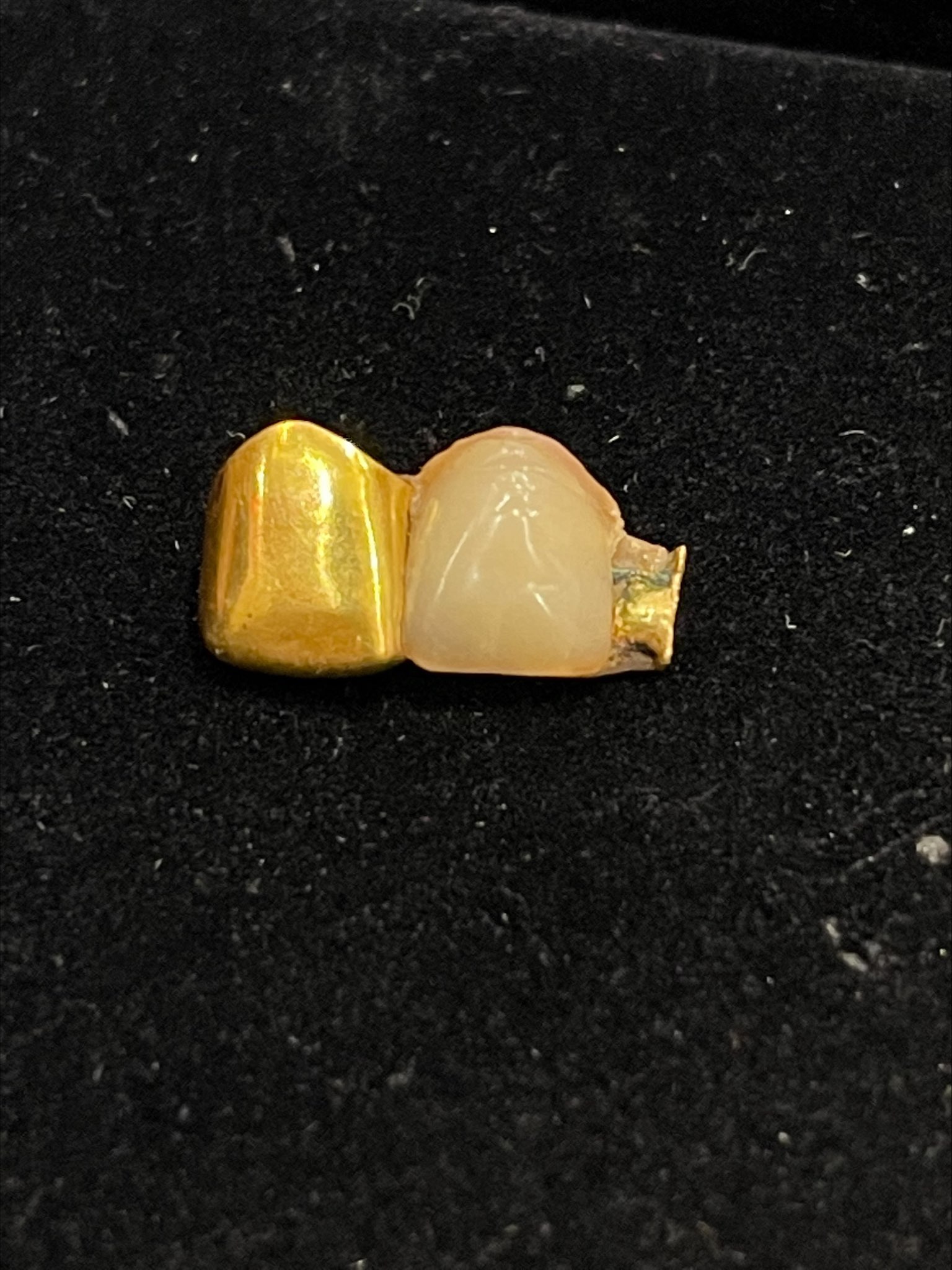 375 gold tooth